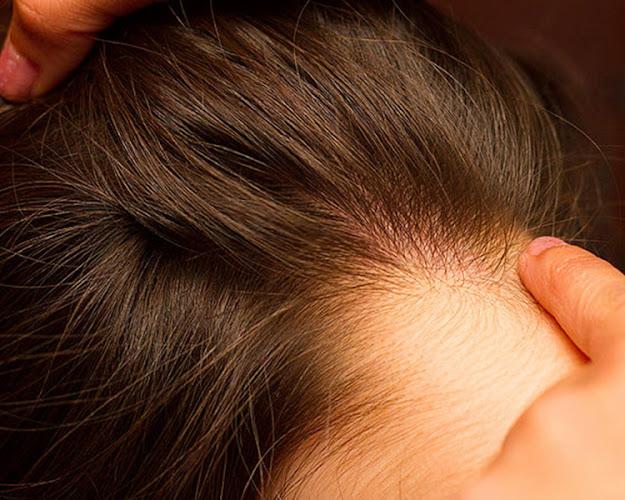 LiceWiz - lice treatment clinic in Hollywood, FL