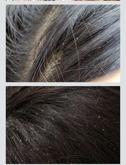 Lice lady in pink - lice treatment clinic in Service Area, NJ