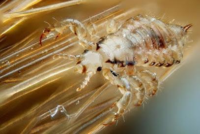Lice Happens - lice treatment clinic in Service Area, NJ
