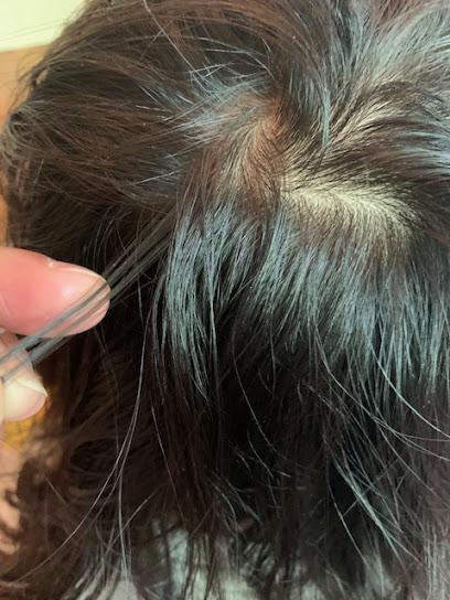 LiceDoctors Lice Treatment and Lice Removal Middlesex County, Central New Jersey - lice treatment clinic in Middlesex County, NJ