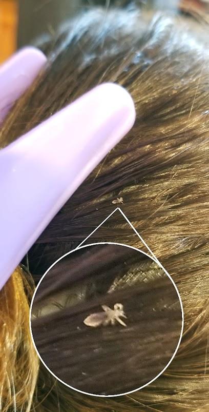 Lice Removal Park Slope - lice treatment clinic in Service Area, NJ