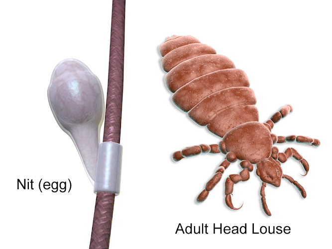 Lice Care Associates Danvers & Boston - lice treatment clinic in Danvers, MA