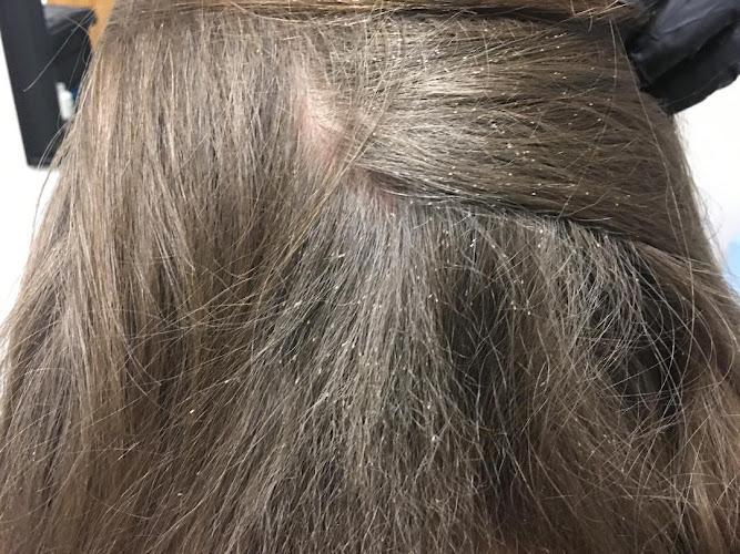 Lice Clinics of America - Little Rock - lice treatment clinic in Cabot, AR
