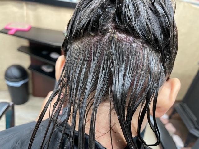 Get Lost Lice - lice removal clinic in Fergus Falls, MN