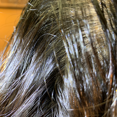 The Dublin Lice Nanny-Lice Treatment - lice treatment clinic in Dublin, OH